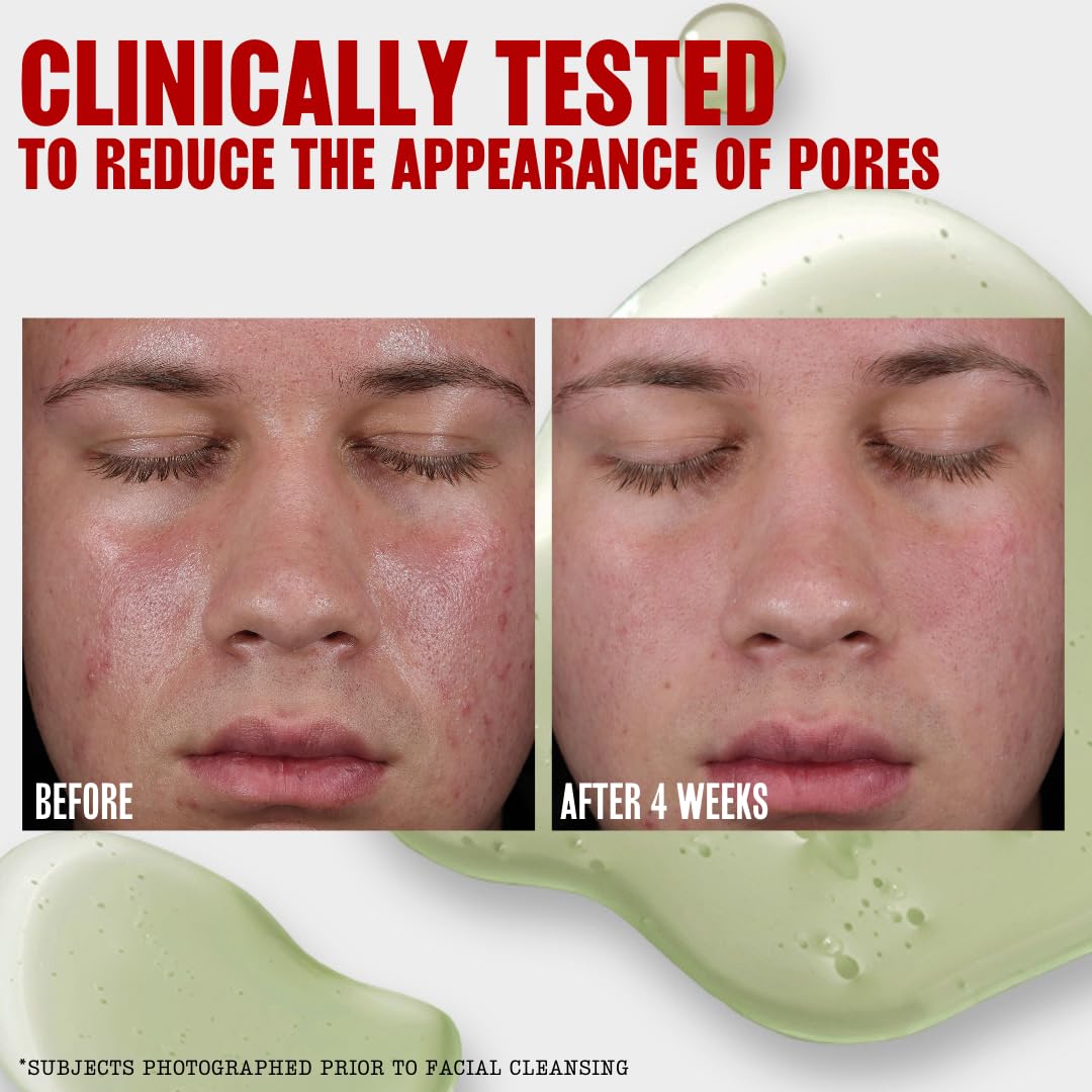 Poros visibles reducidos con Thayers Tonico Gel en uso regular.
