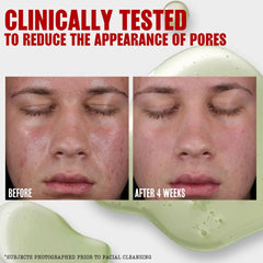 Poros visibles reducidos con Thayers Tonico Gel en uso regular.