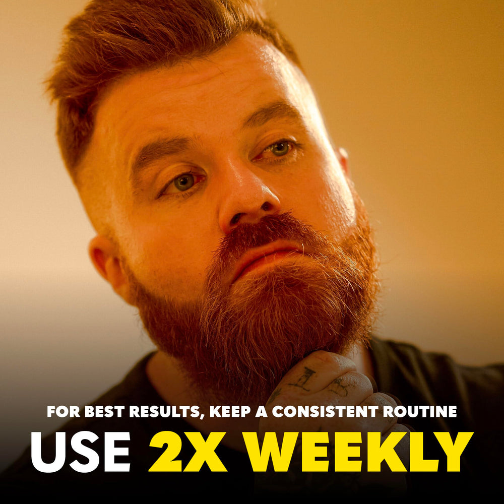 The Beard Club Premium Derma Roller with 540 titanium needles for gentle skin stimulation.