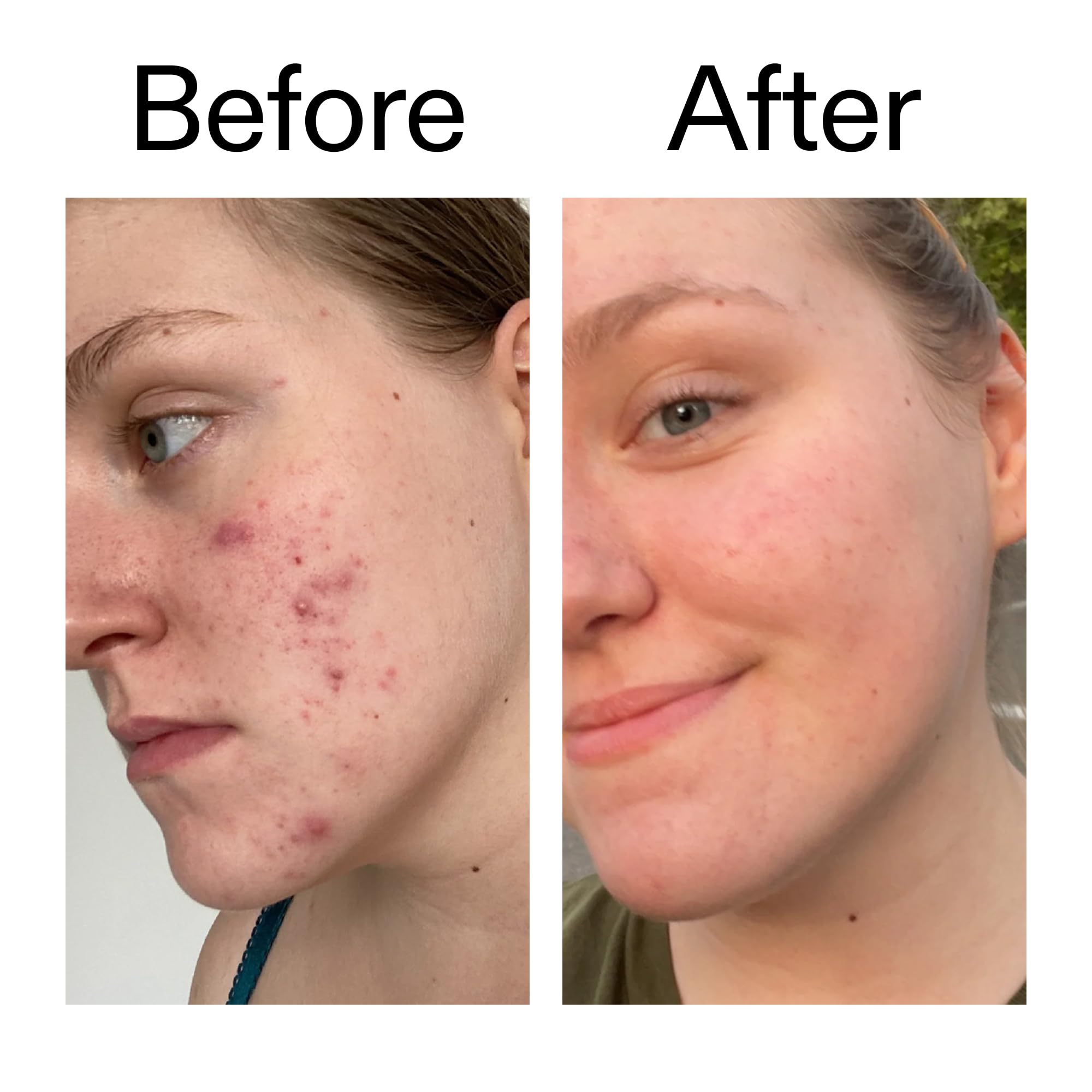 Daily-use serum supports more even tone and subtle glow