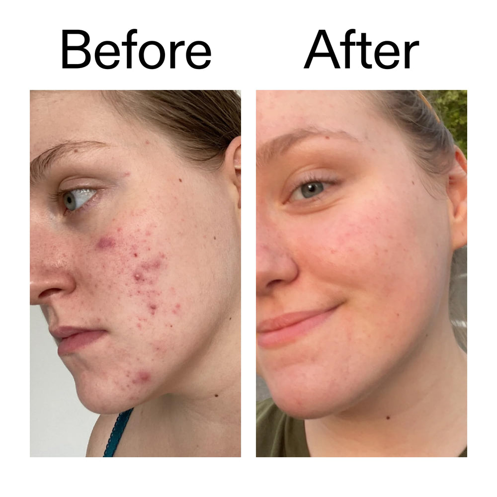 Daily-use serum supports more even tone and subtle glow