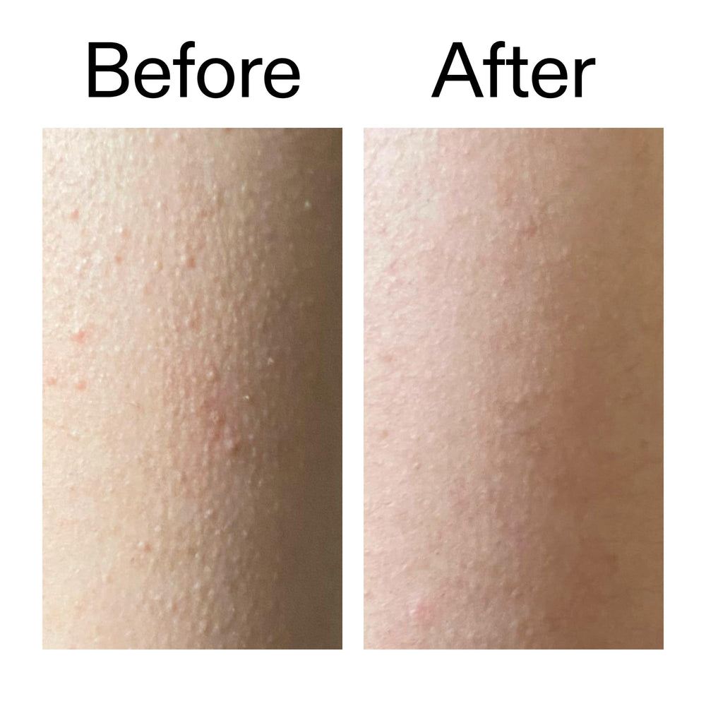 The INKEY List Glycolic Exfoliating Body Stick bottle close-up.