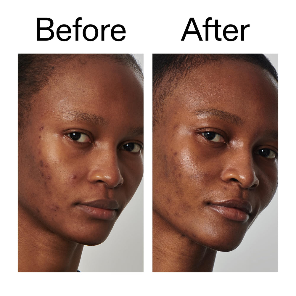 The INKEY List Niacinamide 20% Serum en rutina diaria, fácil de incorporar
