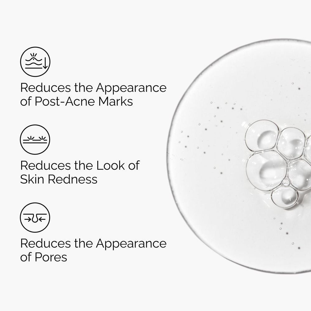 The Ordinary Aloe 2% + NAG 2% en textura ligera, piel más uniforme.