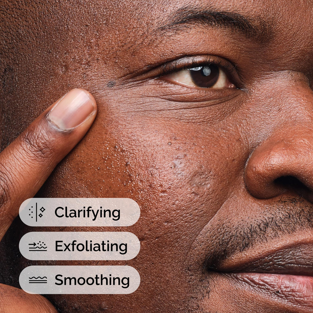 Applying The Ordinary serum on the skin for surface exfoliation and smoother skin.