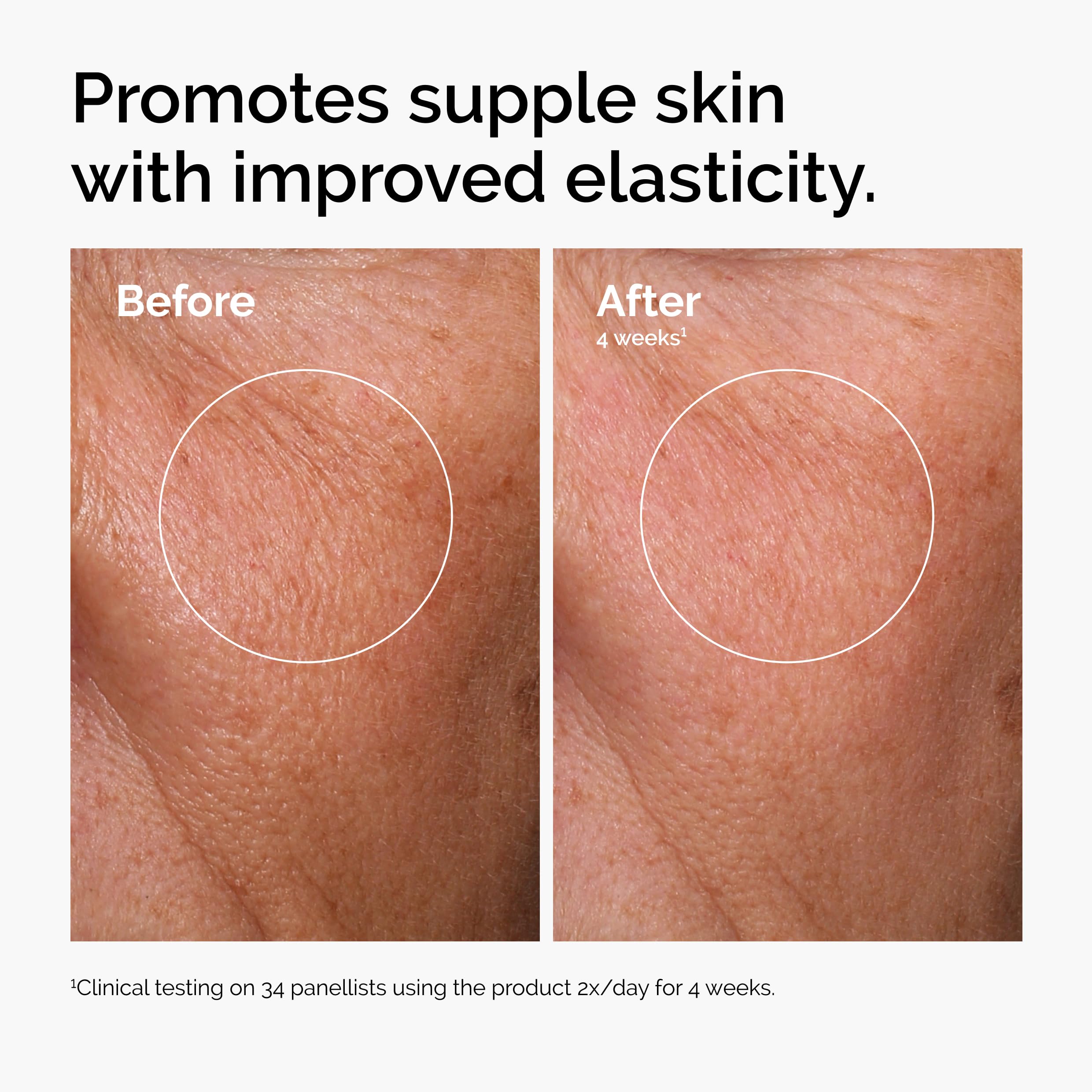 The Ordinary Niacinamide zinc bottle showcasing clear complexion support