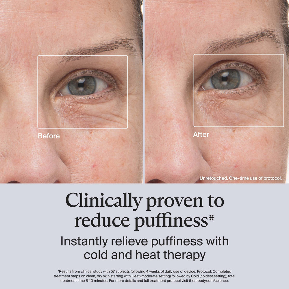 TheraFace eye-area applicator for precise depuffing near the eyes.