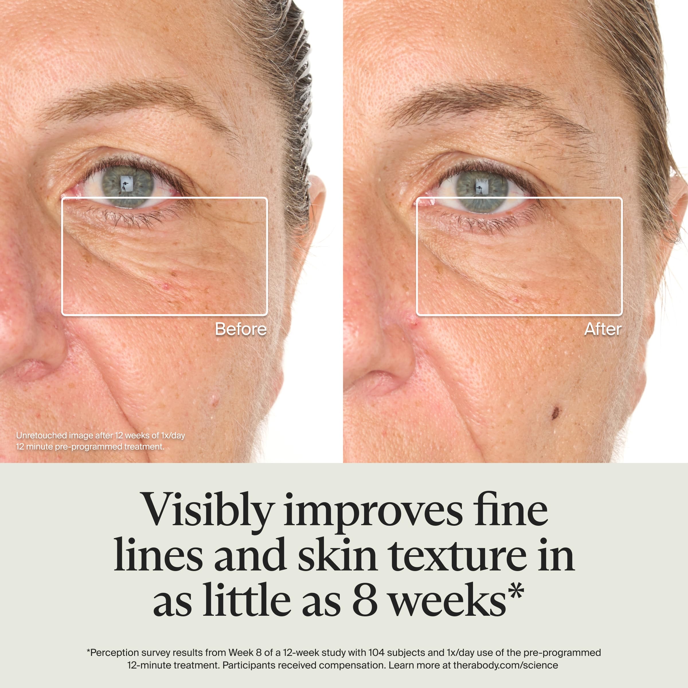 TheraFace Glo infrared light for potential collagen support