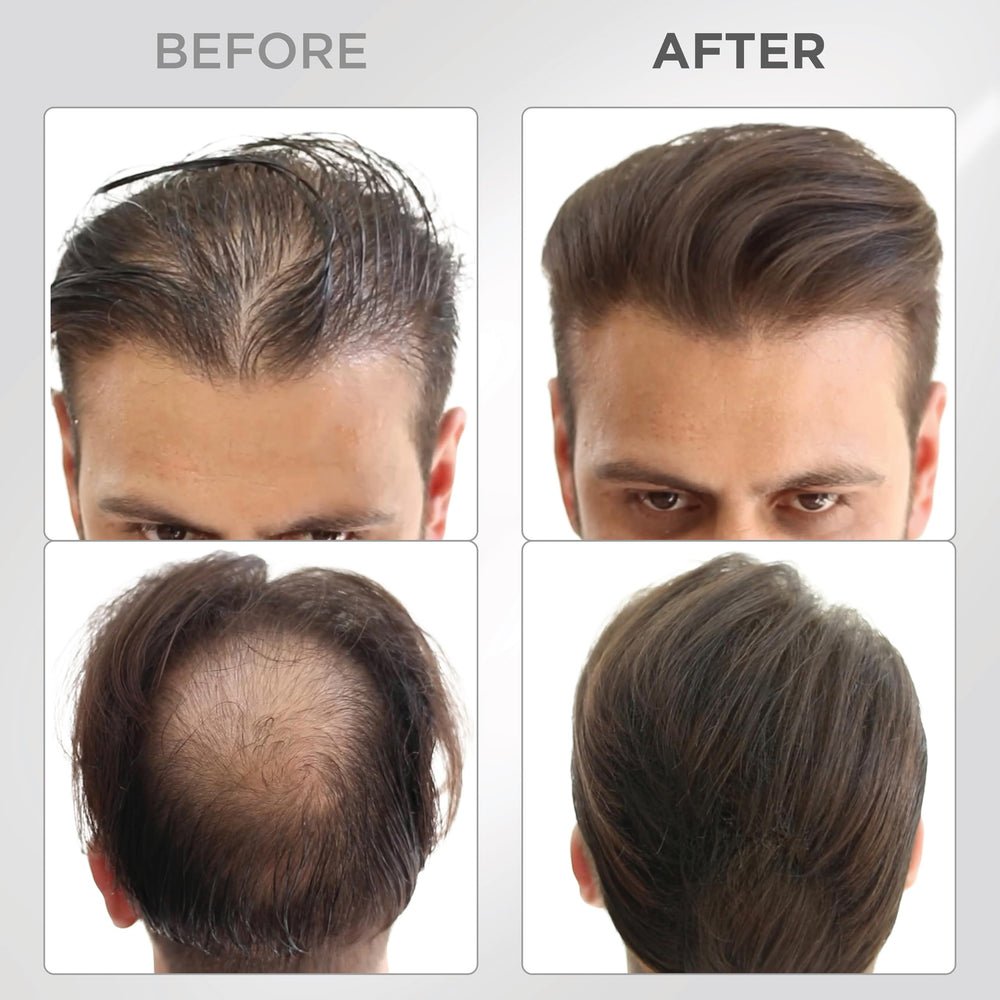 Thick Fiber keratin fibers closeup highlighting natural texture and fullness.