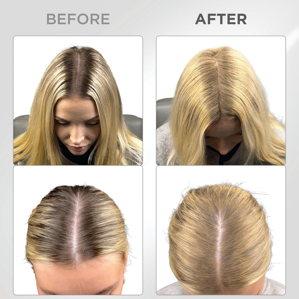 Thick Fiber Root Touch Up Powder blonde hairline concealment for thinning areas.