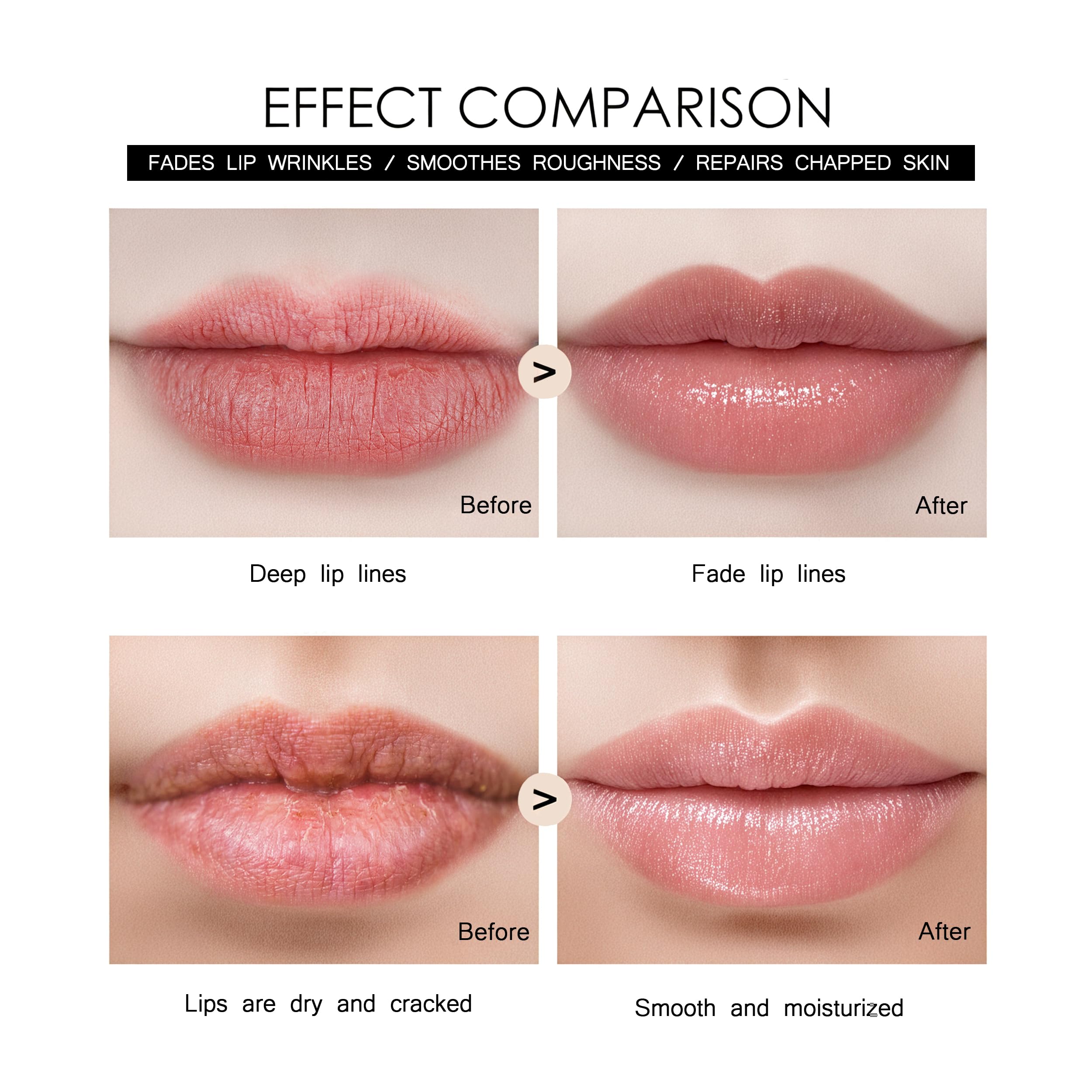 Tidewish Derma Roller lip focus for gentle plumping and fine lines