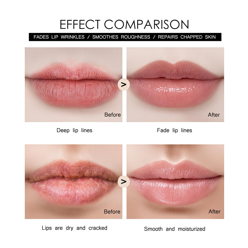 Tidewish Derma Roller lip focus for gentle plumping and fine lines