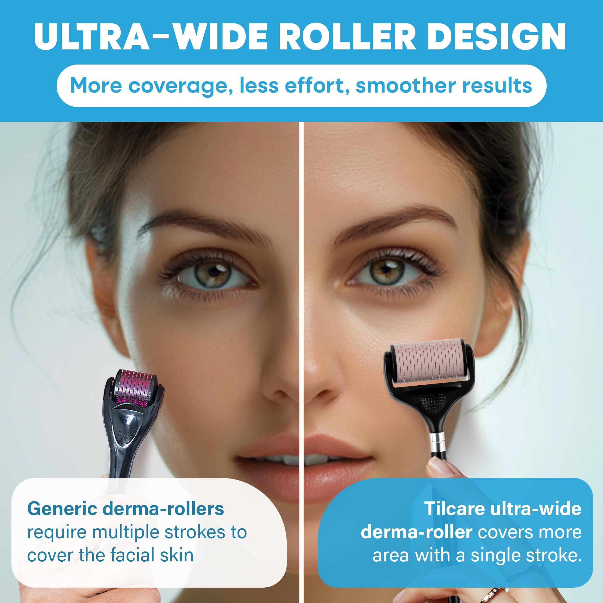 Tilcare roller used on beard for precise microchannel application.