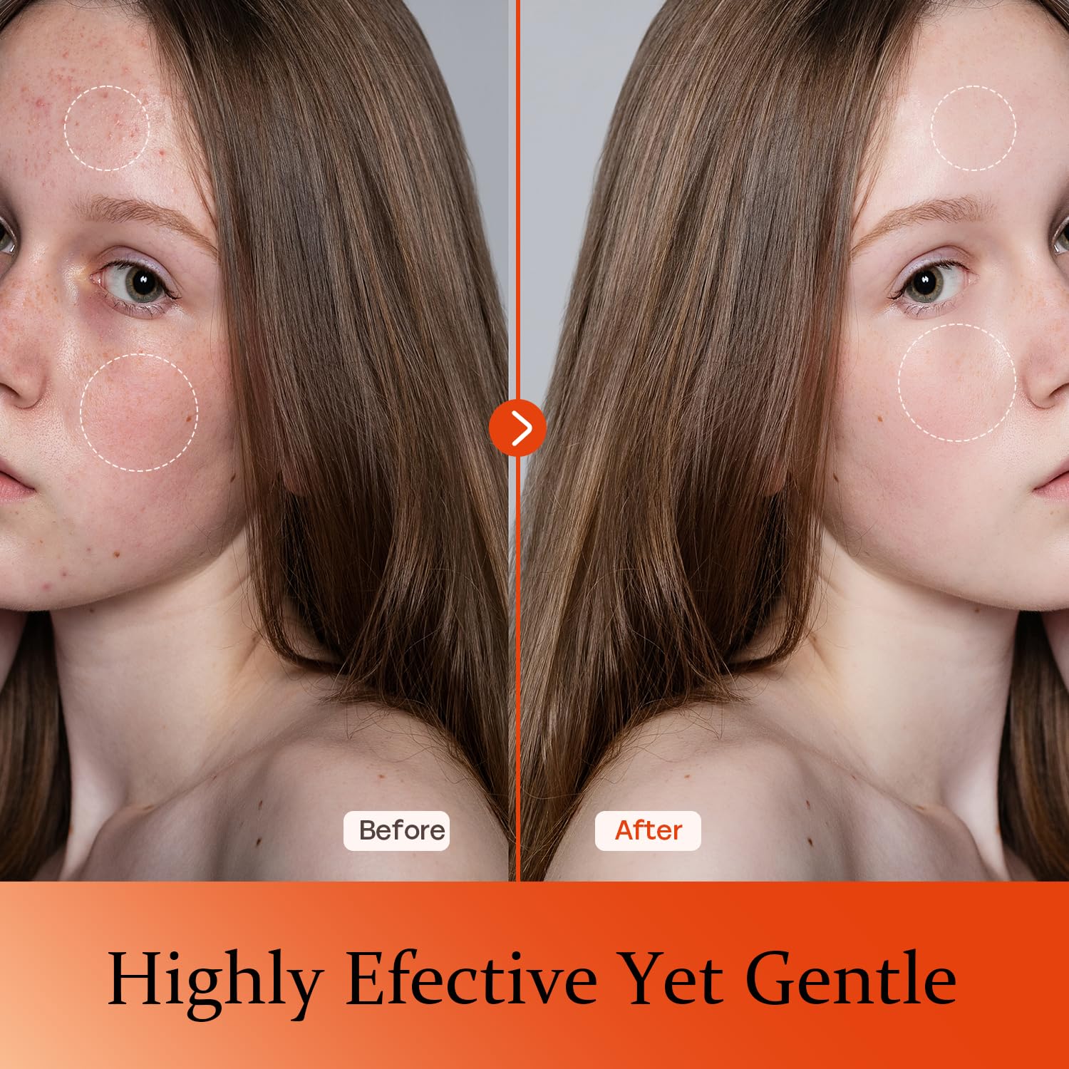 Tinclen Serum Vitamina C: aplicación suave en rostro para tono uniforme