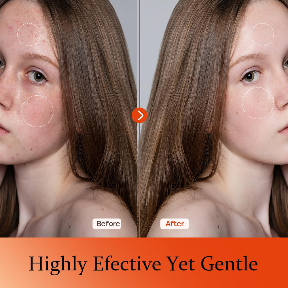 Tinclen Serum Vitamina C: aplicación suave en rostro para tono uniforme