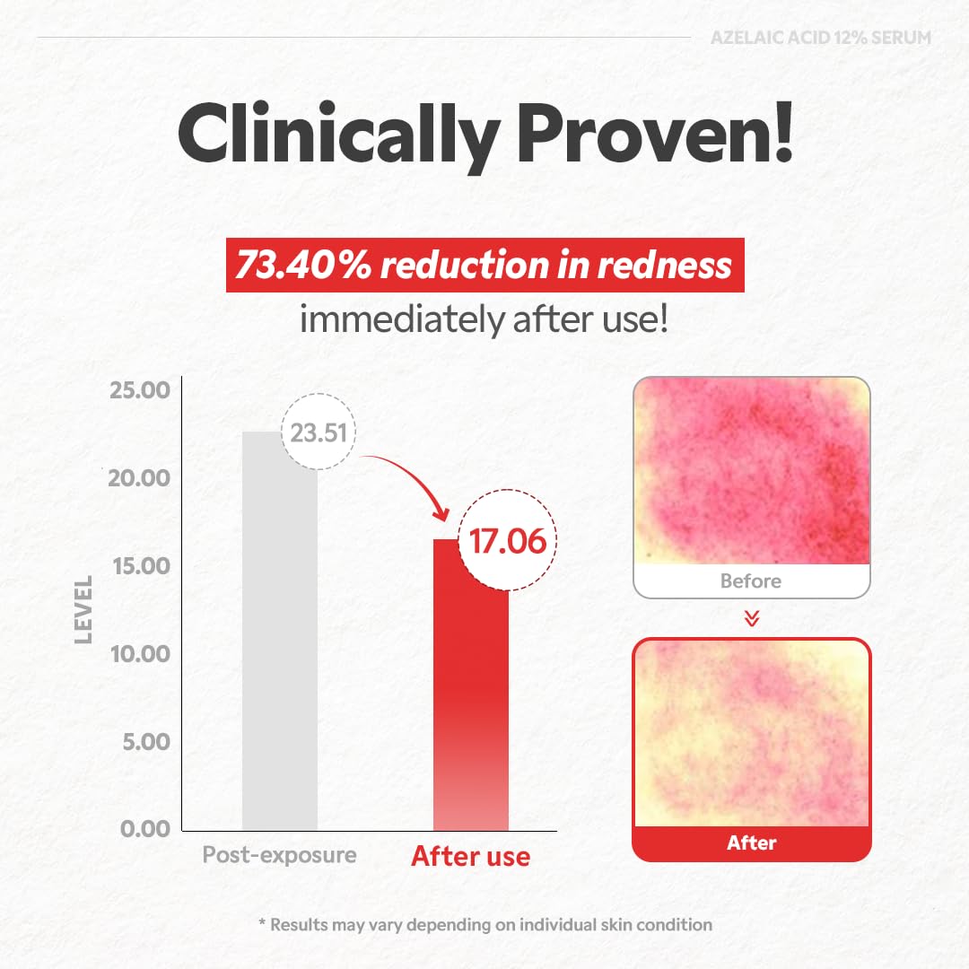TIRTIR Azelaic Acid 12% Serum swatch on skin demonstrating hydration without residue.