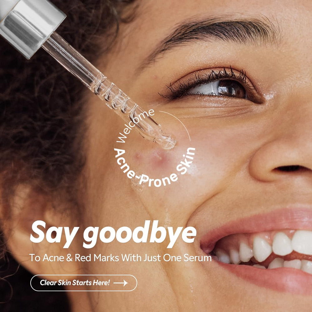 TIRTIR Azelaic Acid 12% Serum dropper delivering a precise, lightweight application.