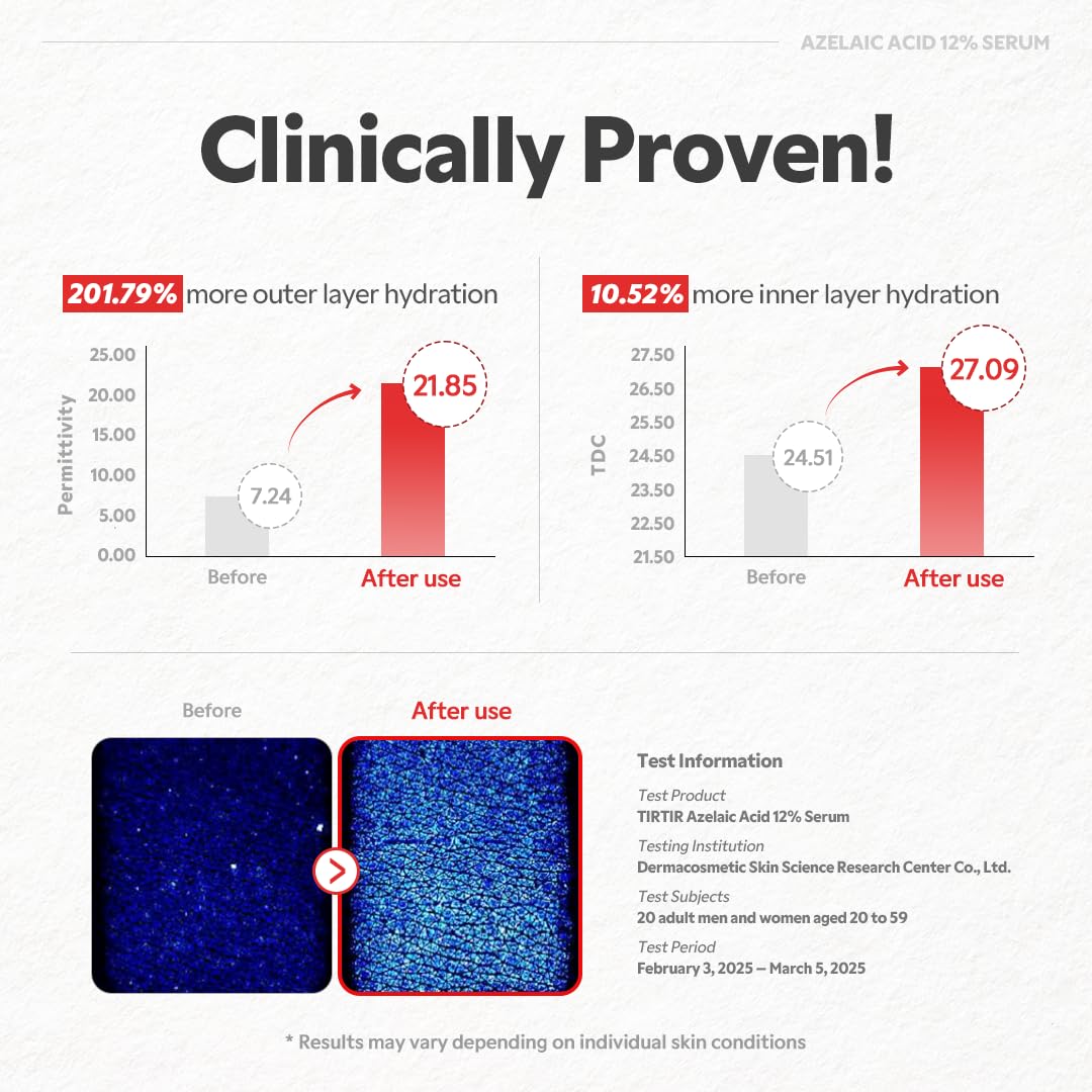 TIRTIR Azelaic Acid 12% Serum in neutral lab-like setting suggests clinical-grade quality.