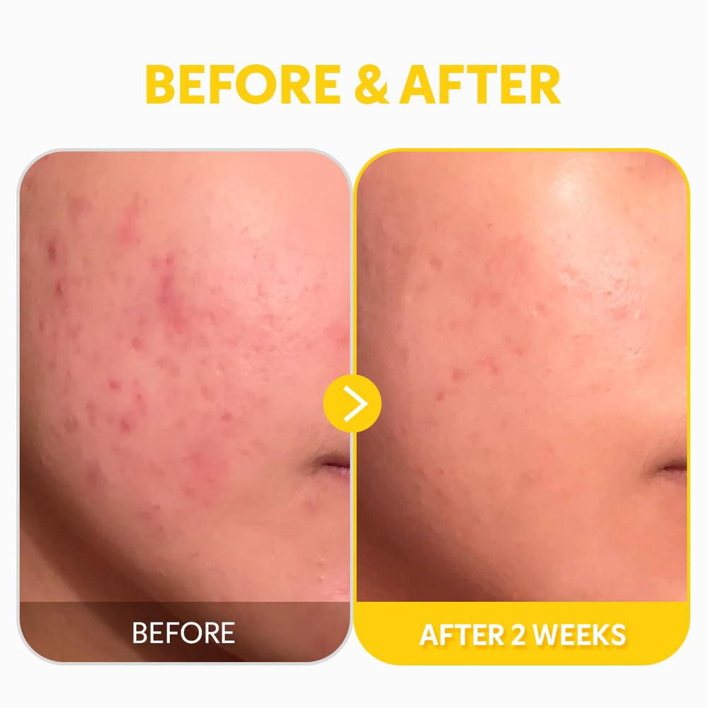 Dermatology-tested label conveys a gentle, non-irritating approach.