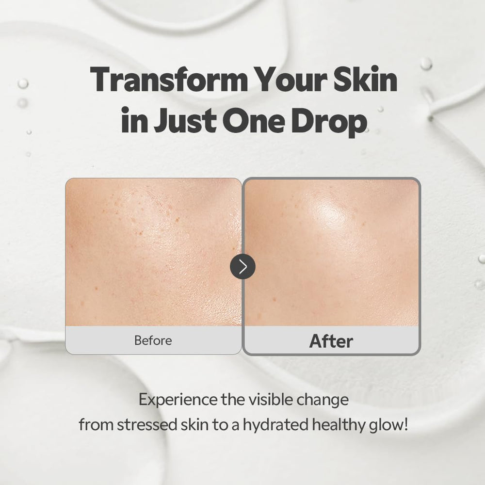 TIRTIR SOS Serum blend of witch hazel and chamomile for soothing skin.