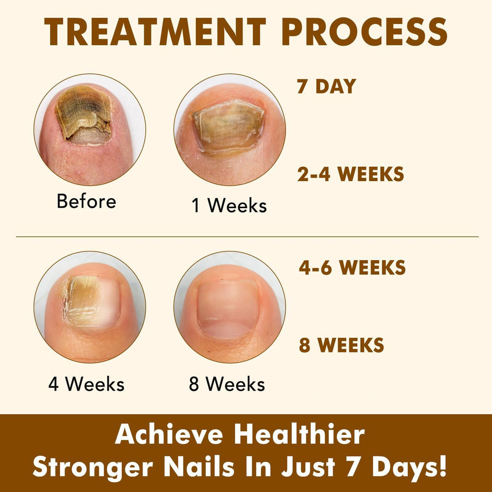 Tiuedu Ginger Nail Serum daily-use scene for consistent nail care.