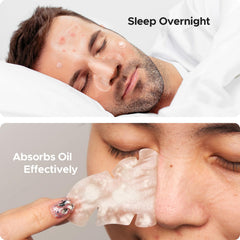 Punto acne TKTK 10mm para imperfecciones moderadas.