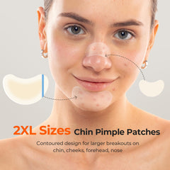 TKTK large contoured 62x42mm patch provides full coverage for bigger chin breakouts.