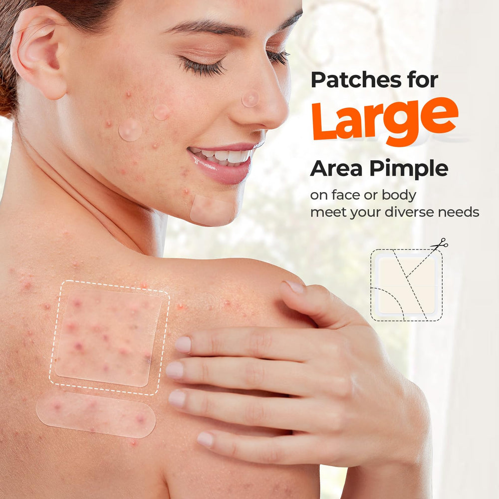 TKTK 12mm dot patch on a blemish gently absorbs fluids overnight