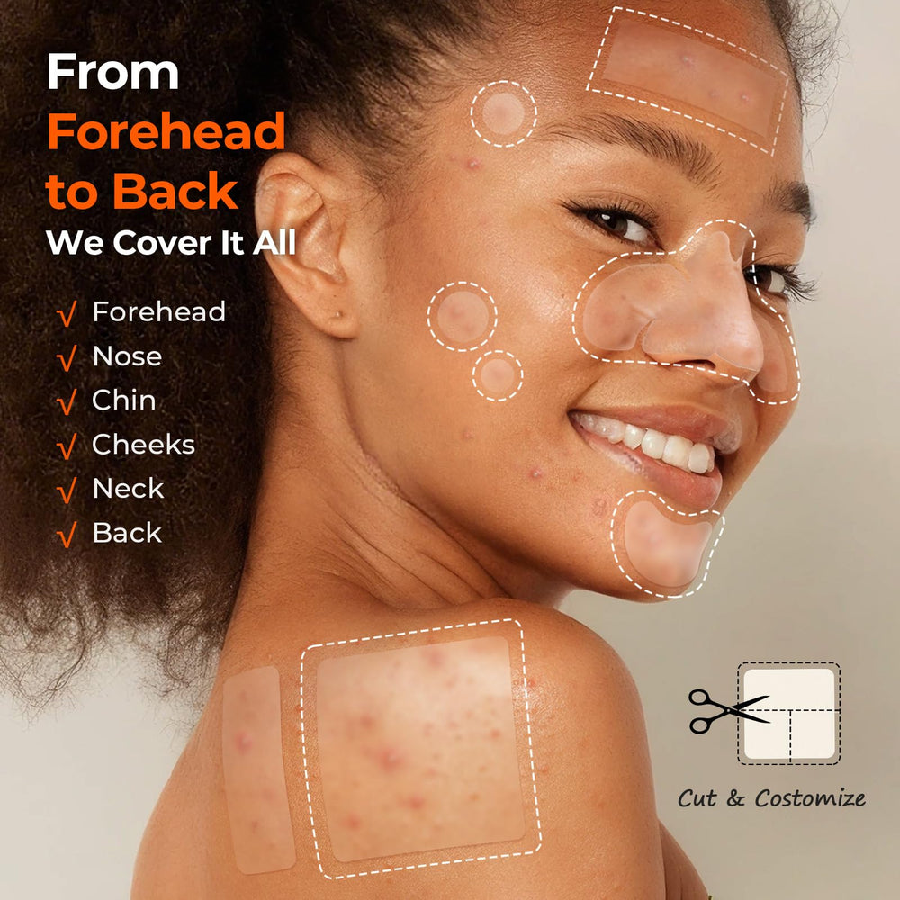TKTK pimple patch 10mm on cheek, absorbs oil and heals