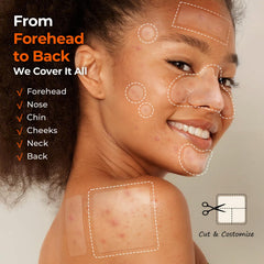 TKTK pimple patch 10mm on cheek, absorbs oil and heals