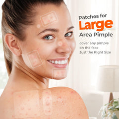 TKTK pimple patches 60x60mm cover larger areas like back or forehead.