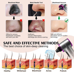 Tlettsteinkle blackhead remover kit contents including heads and tweezers.