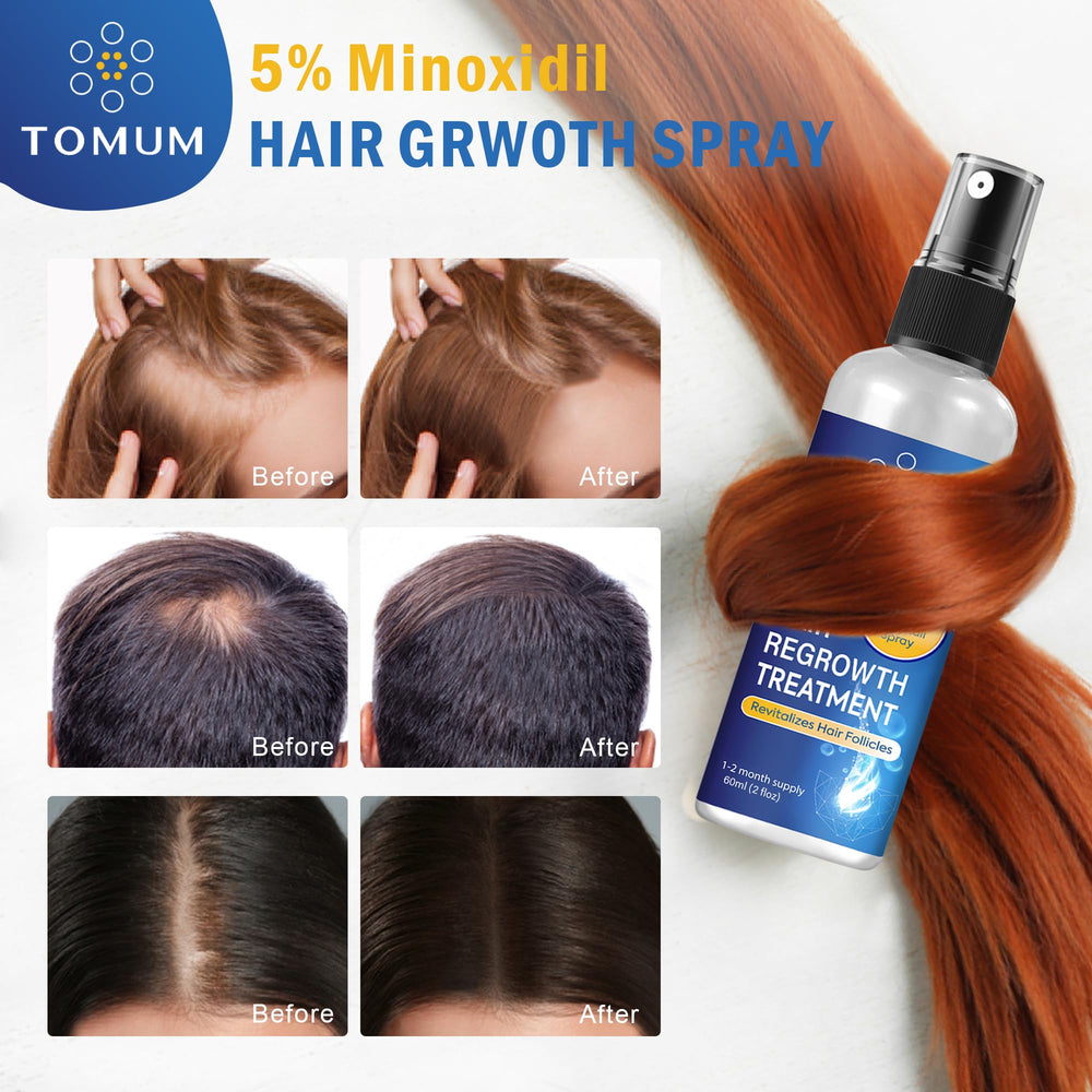 Tomum Minoxidil packaging box arranged for two-pack set.