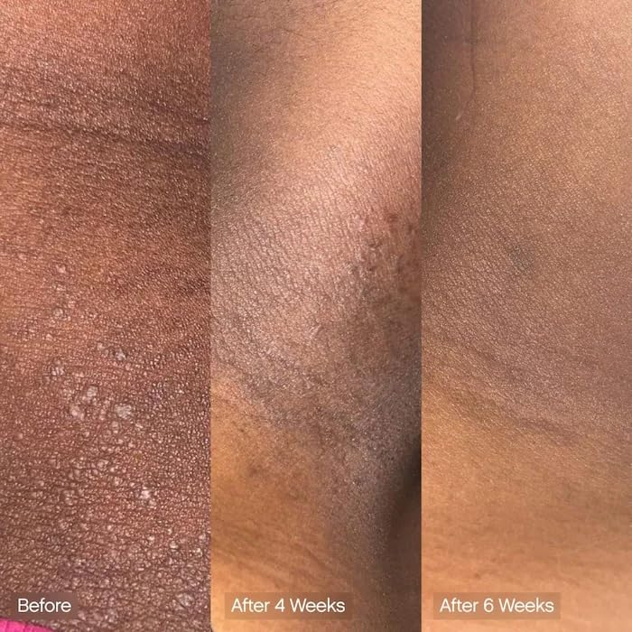 Topicals Faded cleansing bar vegan symbol signals plant-based cleansing.