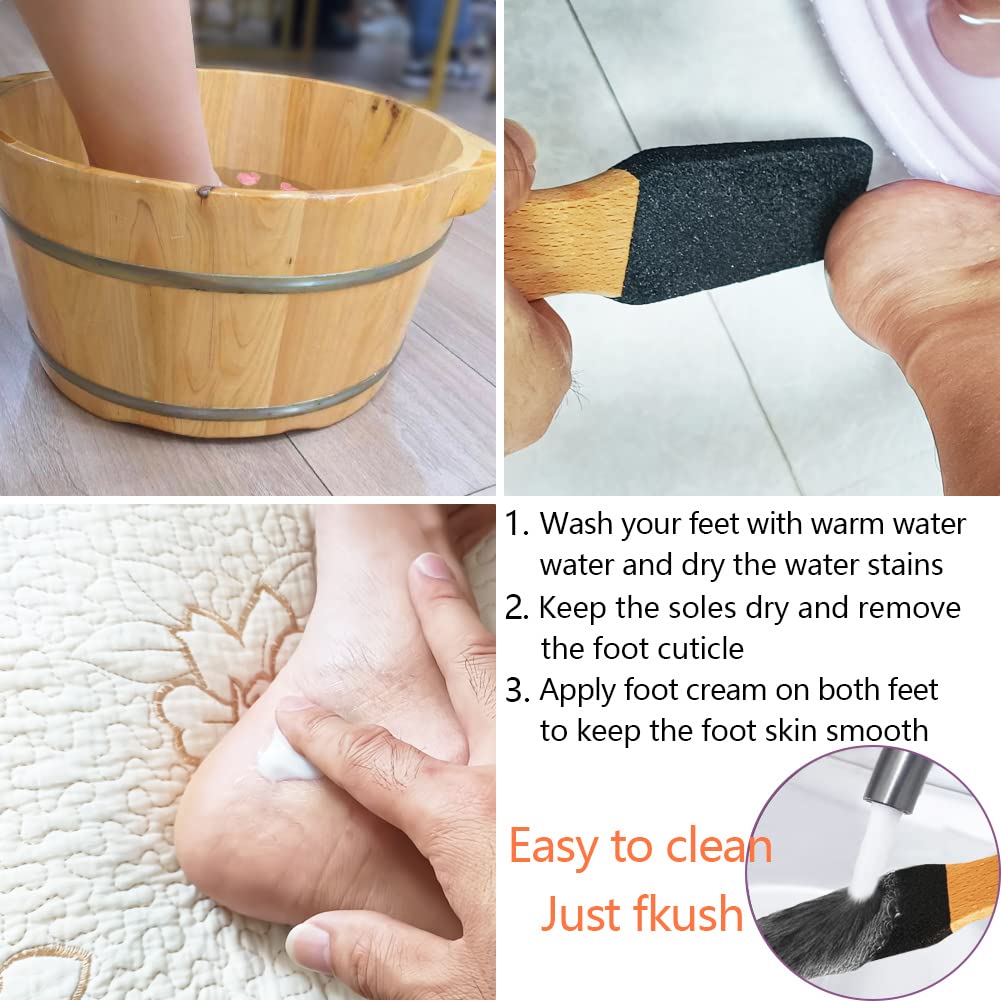 TopMeet foot file leaves feet smooth and soft after use.