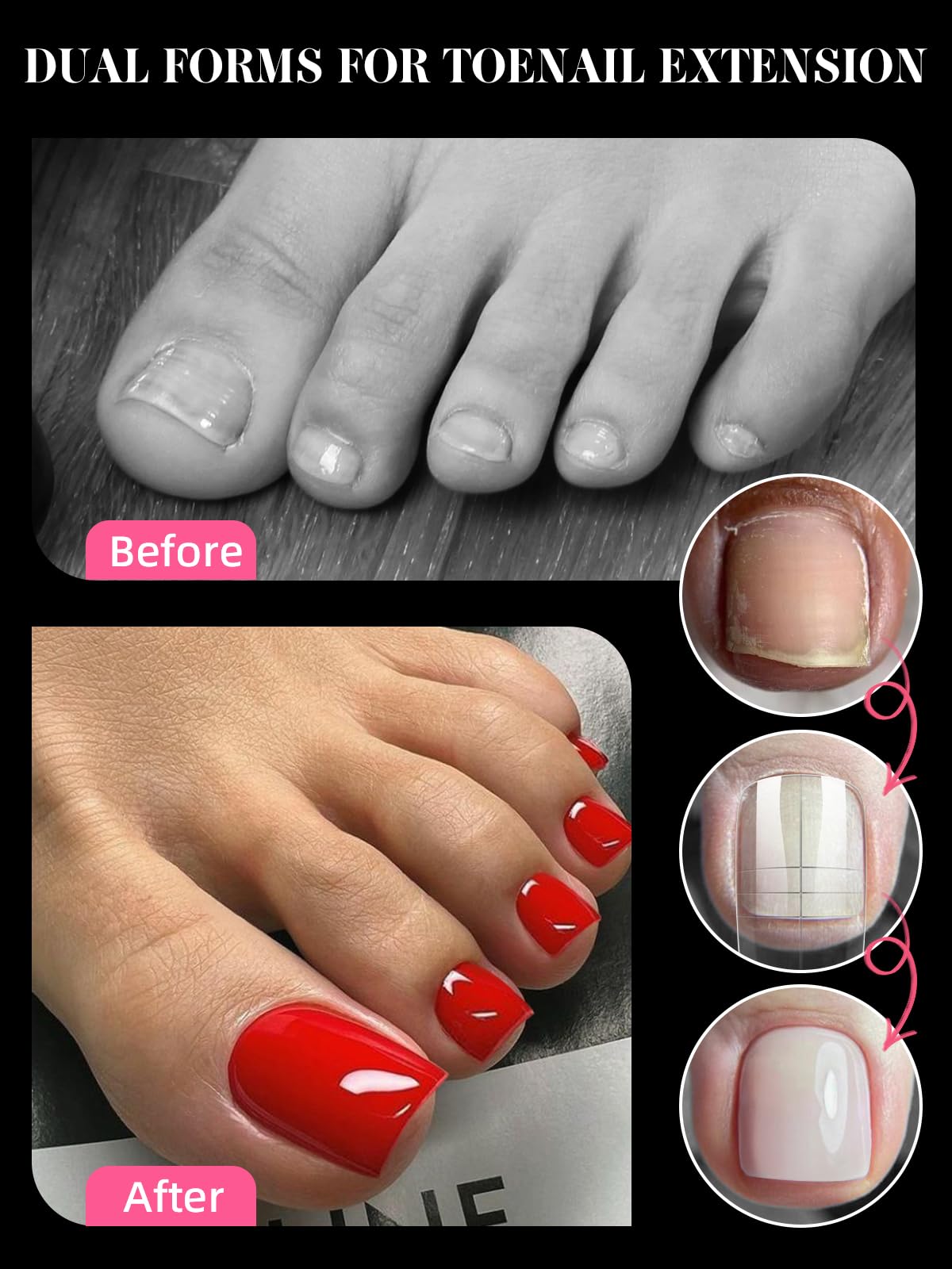 TOROKOM tallas 15, diseño ideal para cubrir uñas.