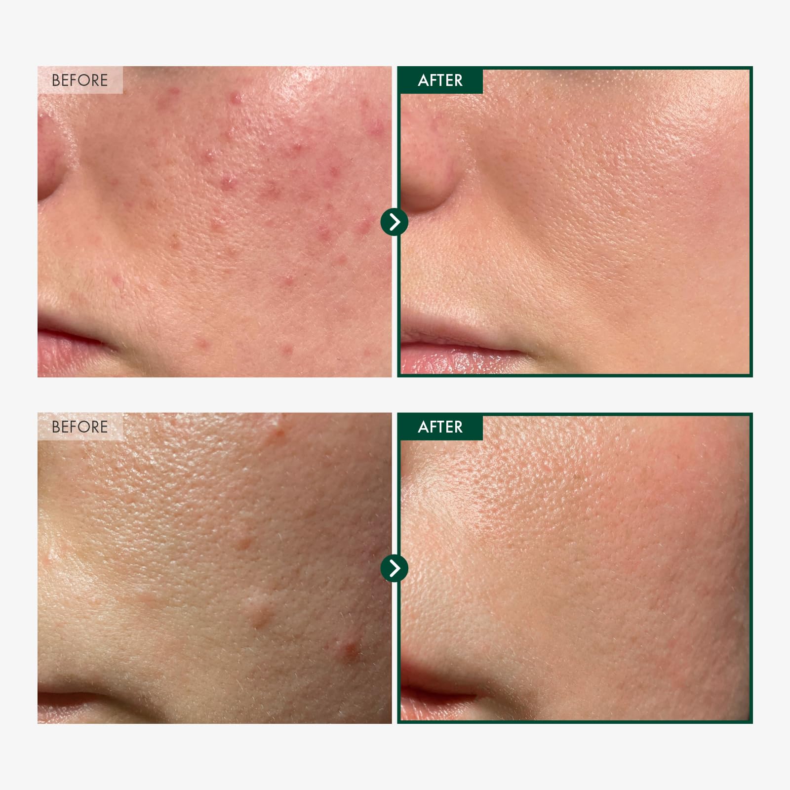 TOSOWOONG ampoule dropper close-up for fast calming application.
