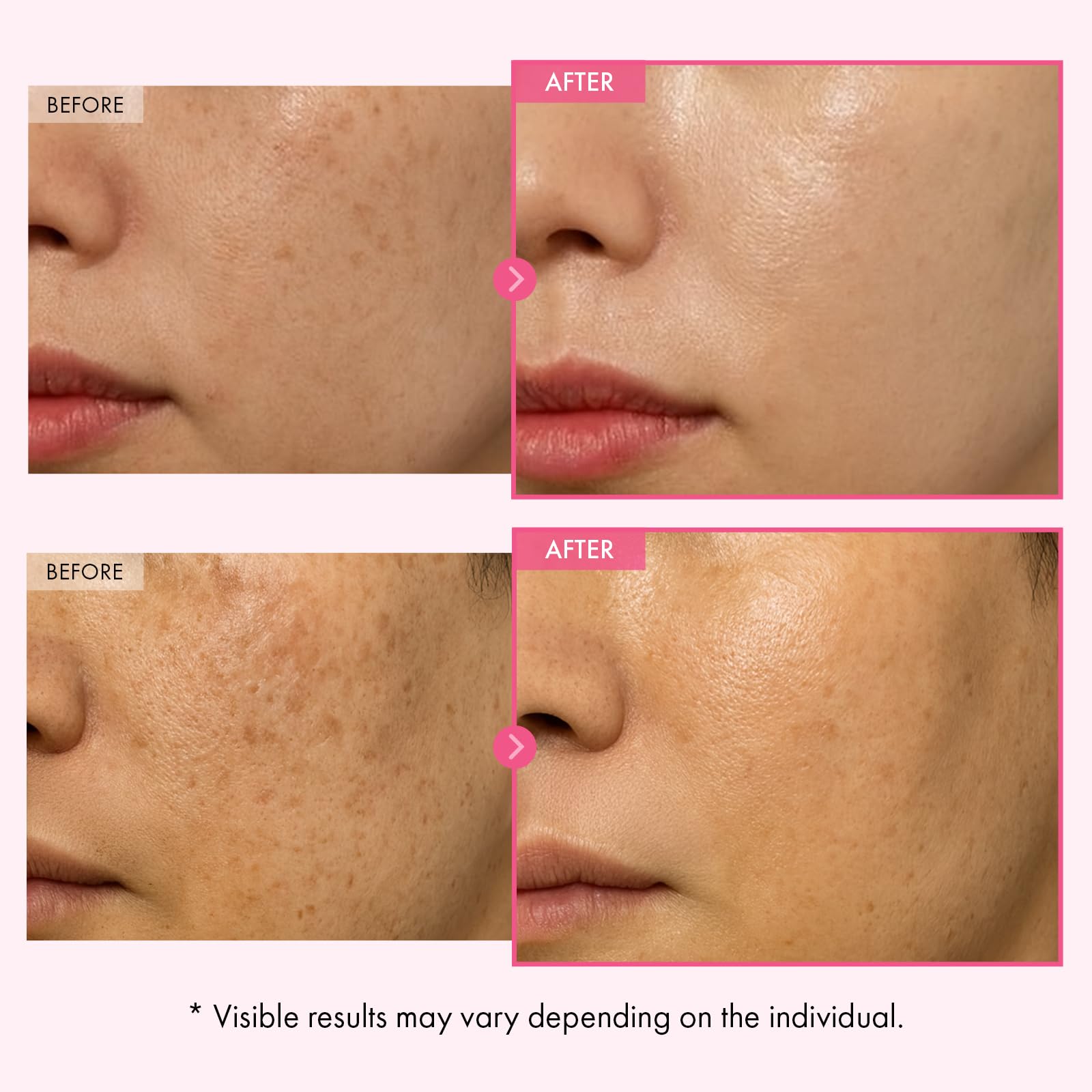 TOSOWOONG Arbutin Glutathione Cream texture swatch suggests light, non-greasy finish.