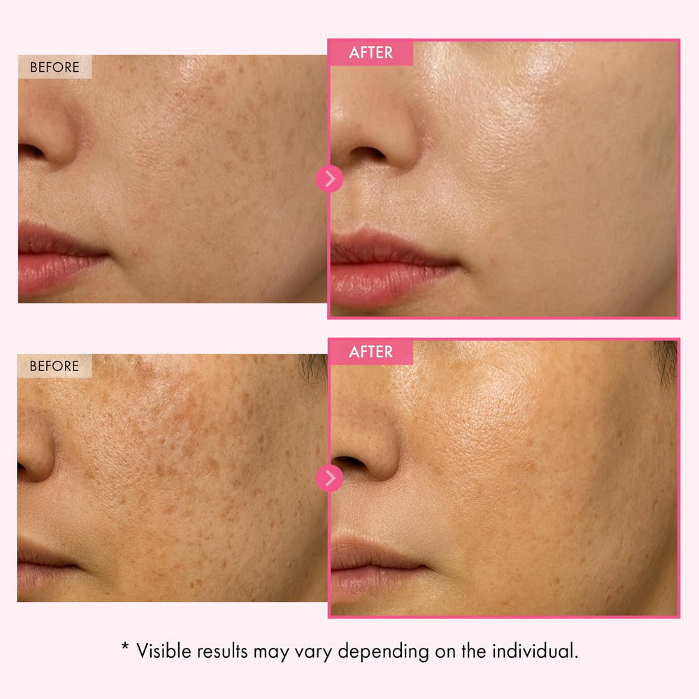 TOSOWOONG Arbutin Glutathione Cream texture swatch suggests light, non-greasy finish.