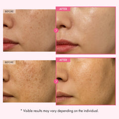TOSOWOONG Arbutin Glutathione Cream texture swatch suggests light, non-greasy finish.