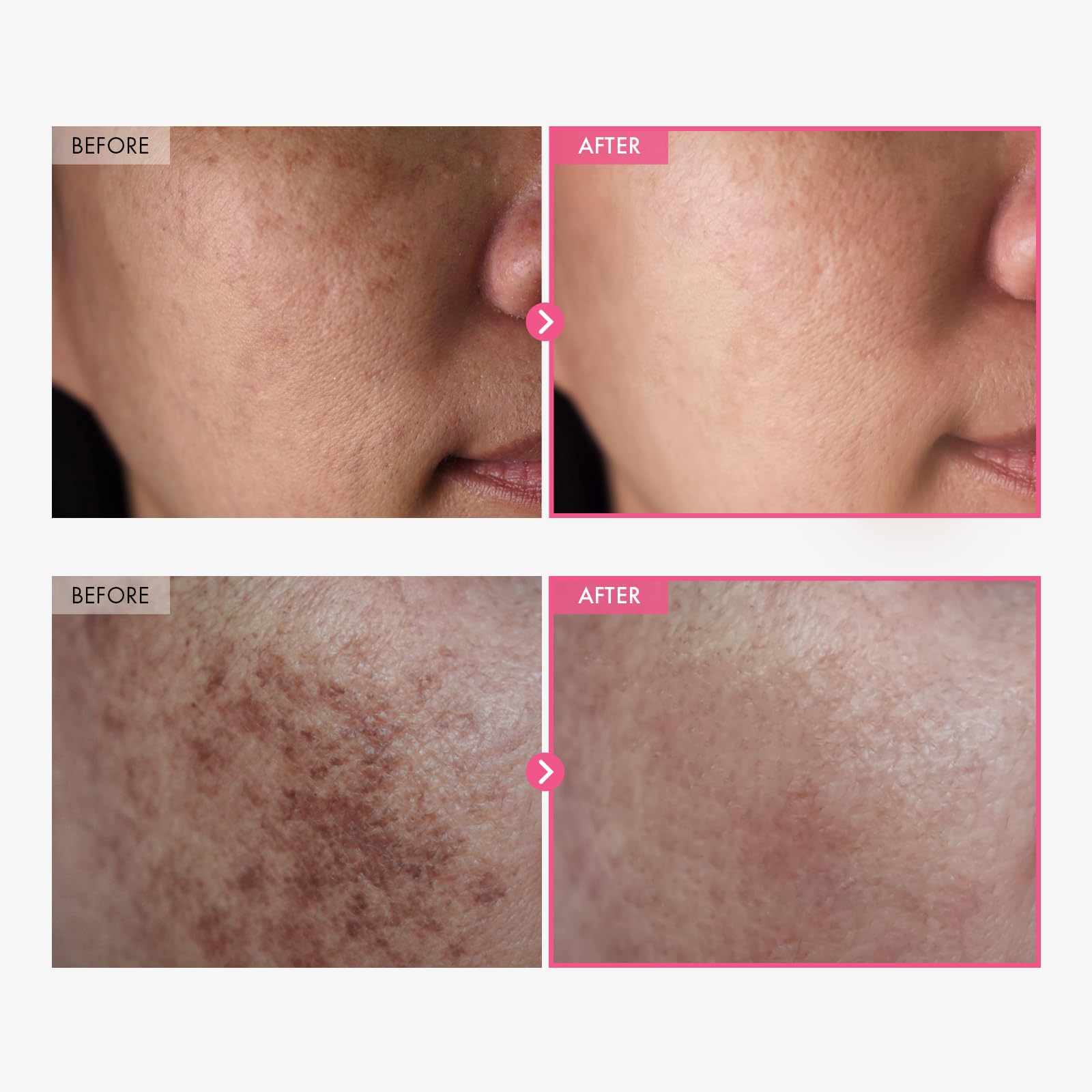 TOSOWOONG arbutin tranexamic cream texture close-up shows smooth non sticky finish.
