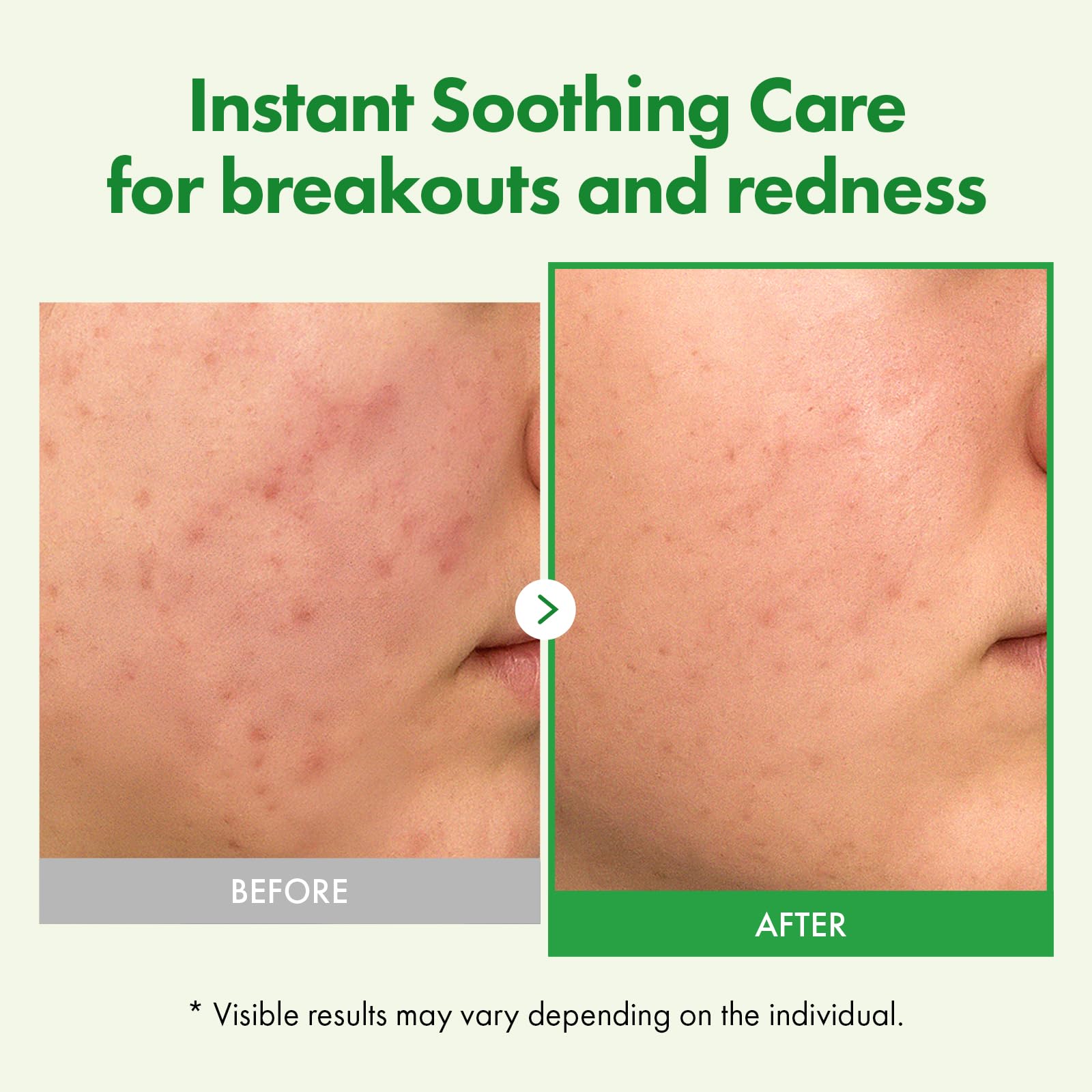 TOSOWOONG Madagascar Centella leaf water swirl emphasizes hydration and barrier support.