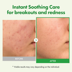 TOSOWOONG Madagascar Centella leaf water swirl emphasizes hydration and barrier support.