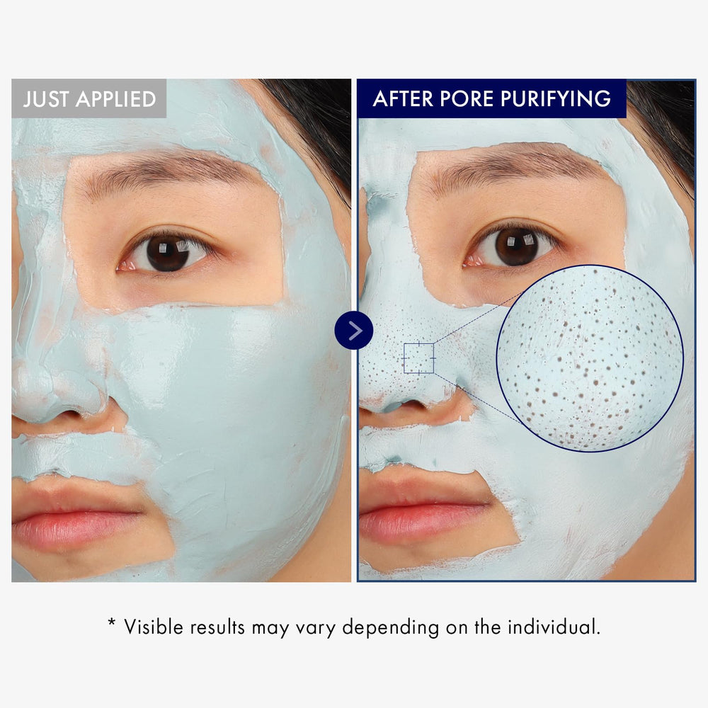 Tosowoong Real Blackhead: sensación refrescante que revitaliza la piel durante el tratamiento facial.