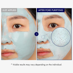 Tosowoong Real Blackhead: sensación refrescante que revitaliza la piel durante el tratamiento facial.