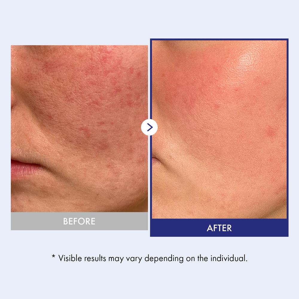 TOSOWOONG Panthenol 20 Barrier Cream ingredient view highlights ceramides and hyaluronic acid for moisture.