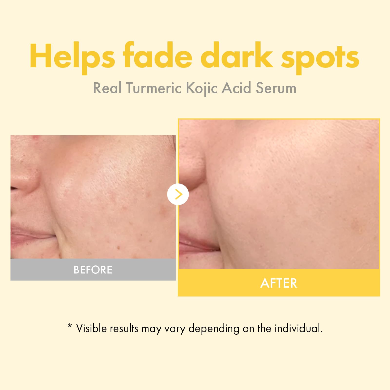 Ingredients highlight kojic acid and turmeric in the Real Turmeric Serum