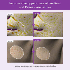 Real Retinol 0.1% with Bakuchiol supports firmer-looking skin.