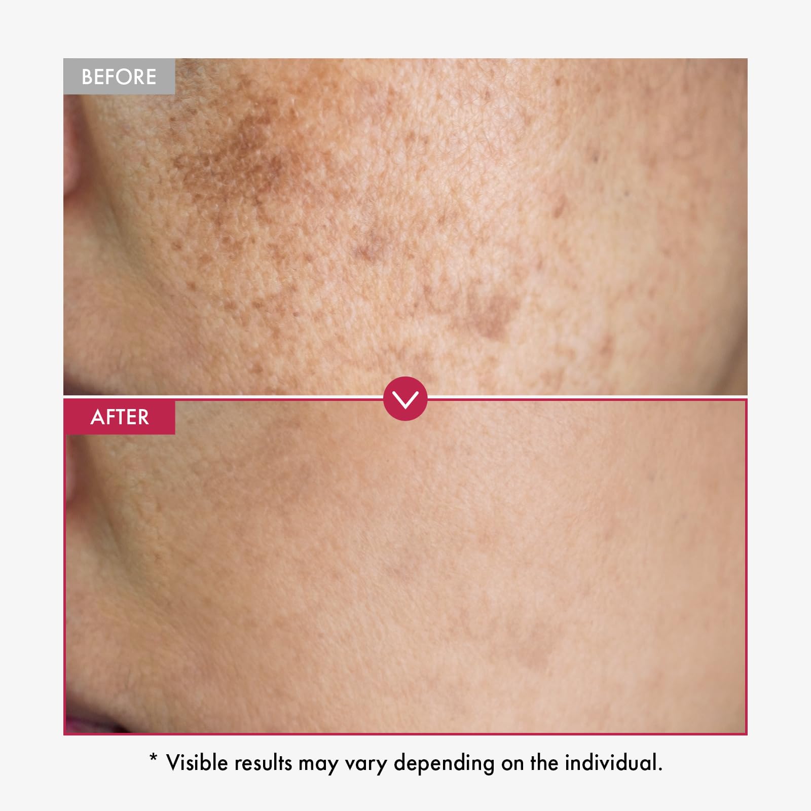 TOSOWOONG serum textura ligera de absorción rápida.