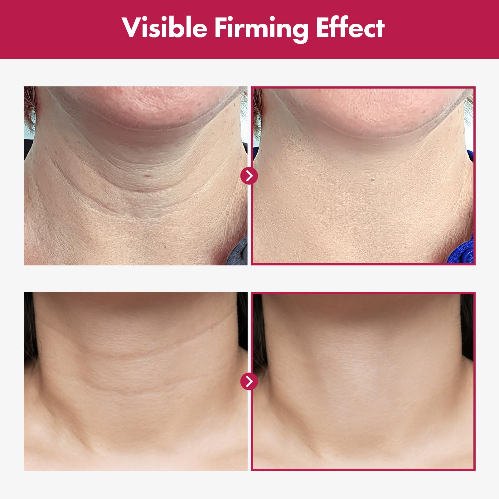 Textura ligera de Tosowoong crema cuello, absorción rápida.